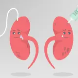 Smutne nerki z kroplówką i strzykawką. Ilustracja symbolizująca kłębuszkowe zapalenie nerek i leczenie.