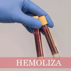 Ręka w niebieskiej rękawiczce trzyma probówki z krwią. Na dole widnieje napis "HEMOLIZA CO TO", wyjaśniający zjawisko rozpadu czerwonych krwinek.