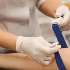 Pobieranie krwi do badań, które mogą wykazać podwyższony mocznik we krwi. Pielęgniarka zakłada opaskę uciskową na ramię pacjenta.