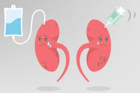 Smutne nerki z kroplówką i strzykawką. Ilustracja symbolizująca kłębuszkowe zapalenie nerek i leczenie.