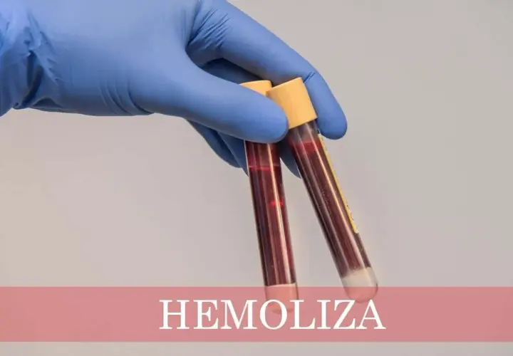 Ręka w niebieskiej rękawiczce trzyma probówki z krwią. Na dole widnieje napis "HEMOLIZA CO TO", wyjaśniający zjawisko rozpadu czerwonych krwinek.
