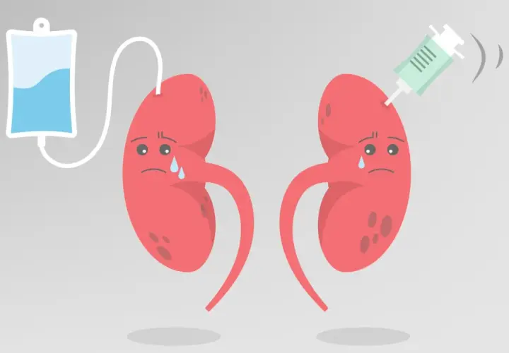 Smutne nerki z kroplówką i strzykawką. Ilustracja symbolizująca kłębuszkowe zapalenie nerek i leczenie.