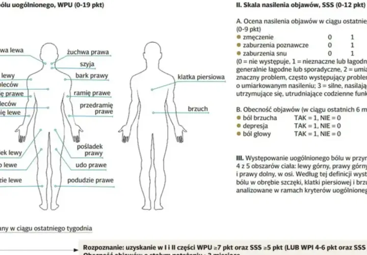 Schemat ciała z zaznaczonymi obszarami bólu, pomocny w ocenie fibromialgii. Co to jest fibromialgia?