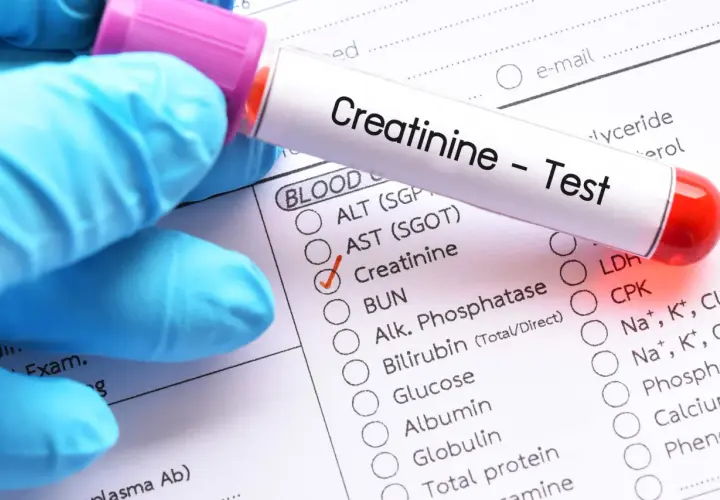 Rękawiczka w niebieskiej rękawiczce trzyma probówkę z napisem "Creatinine - Test". Obok zaznaczono "Creatinine" na formularzu badań.