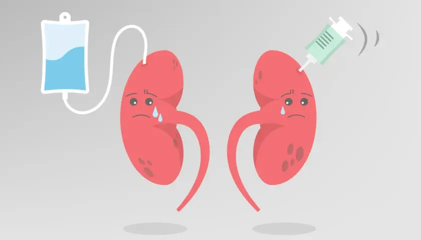 Smutne nerki z kroplówką i strzykawką. Ilustracja symbolizująca kłębuszkowe zapalenie nerek i leczenie.