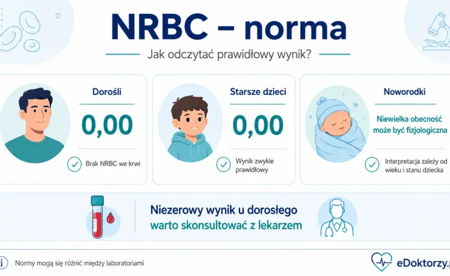 Retikulocyty - norma, badanie i znaczenie wyniku