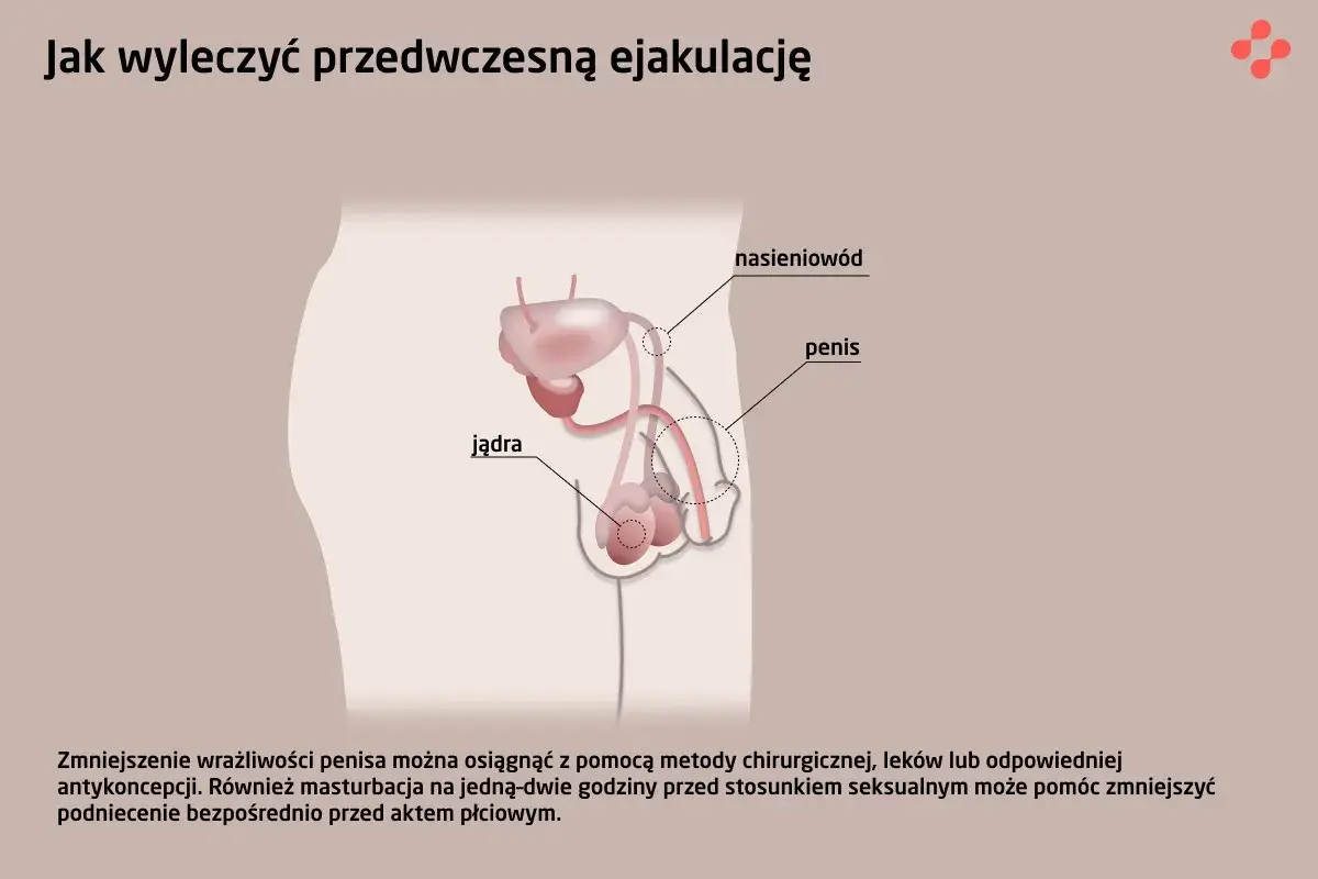 Ilustracja układu rozrodczego męskiego z opisami: jądra, nasieniowód, penis. Tekst wspomina o metodach leczenia przedwczesnego wytrysku.