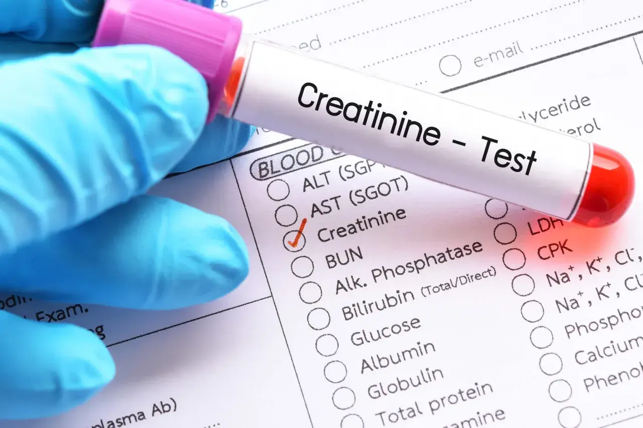 Rękawiczka w niebieskiej rękawiczce trzyma probówkę z napisem "Creatinine - Test". Obok zaznaczono "Creatinine" na formularzu badań.