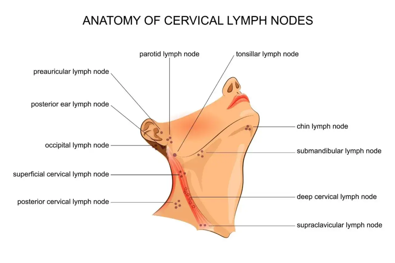 Anatomia węzłów chłonnych szyi. Widać guzek za uchem (tylny węzeł chłonny ucha) oraz inne węzły.