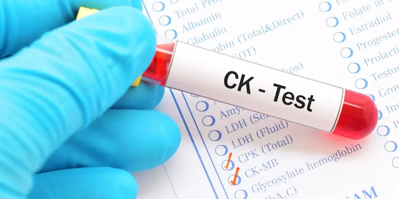 Ręka w niebieskiej rękawiczce trzyma prob&oacute;wkę z krwią do testu CK. Wyniki badań mogą wskazywać na podwyższona kinaza kreatynowa objawy.
