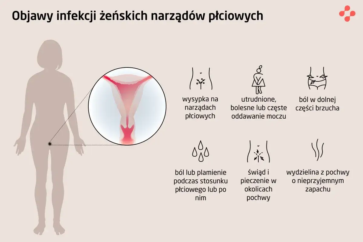Ból podbrzusza po stosunku, wysypka, trudności z oddawaniem moczu, świąd i pieczenie pochwy, nieprzyjemna wydzielina to objawy infekcji narządów płciowych.