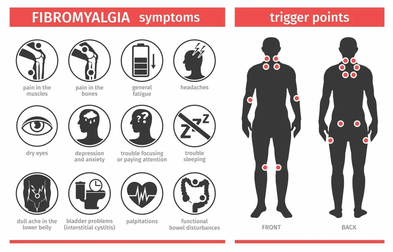 Objawy fibromialgii: b&oacute;l mięśni, kości, zmęczenie, b&oacute;le głowy, problemy z oczami, depresja, trudności z koncentracją, snem, b&oacute;le brzucha, problemy z pęcherzem, kołatanie serca.