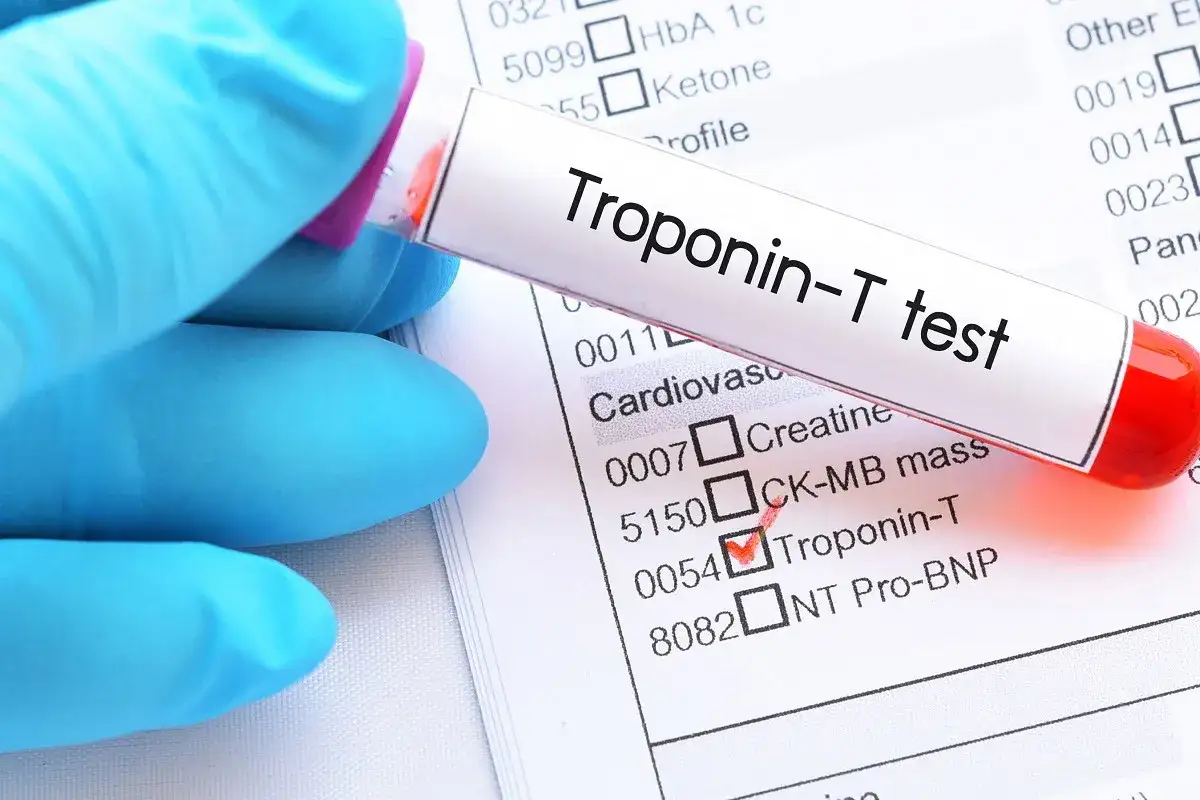 Ręka w niebieskiej rękawiczce trzyma prob&oacute;wkę z krwią do testu troponiny-T. Wyniki badań laboratoryjnych pokazują zaznaczoną pozycję 