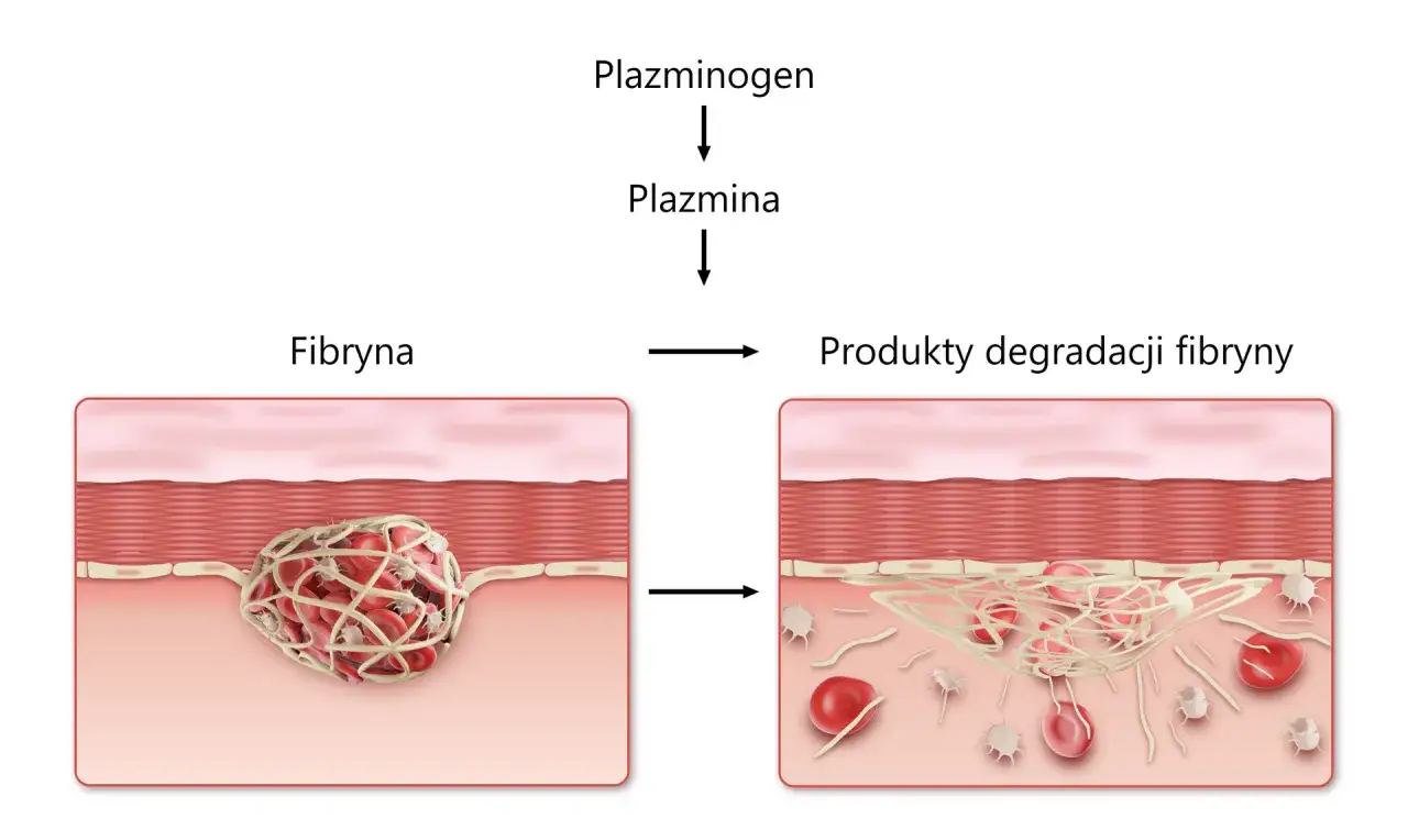 Schemat procesu fibrynolizy: plazminogen przekształca się w plazminę, która rozkłada fibrynę (zakrzep) na produkty degradacji.